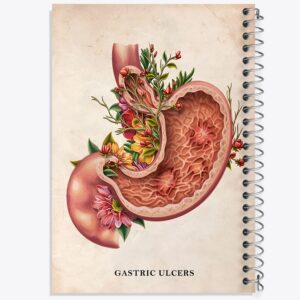 دفتر بیماری زخم معده (Gastric Ulcers)