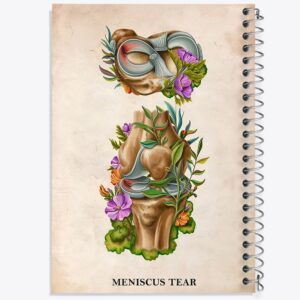 دفتر پارگی منیسک (Meniscus Tear)