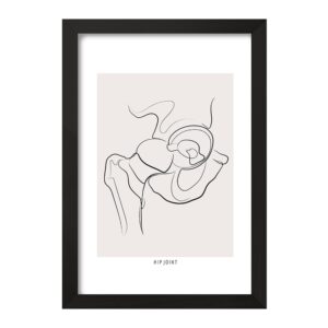 تابلو مفصل ران (Hip Joint)